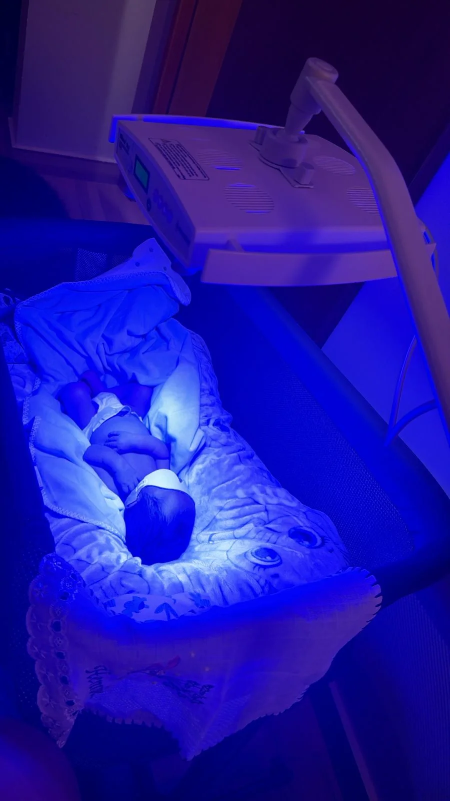 Bebê com fototerapia domiciliar