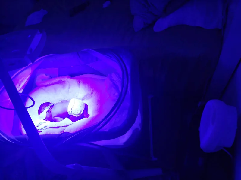 Mãe e bebê durante banho de luz domiciliar