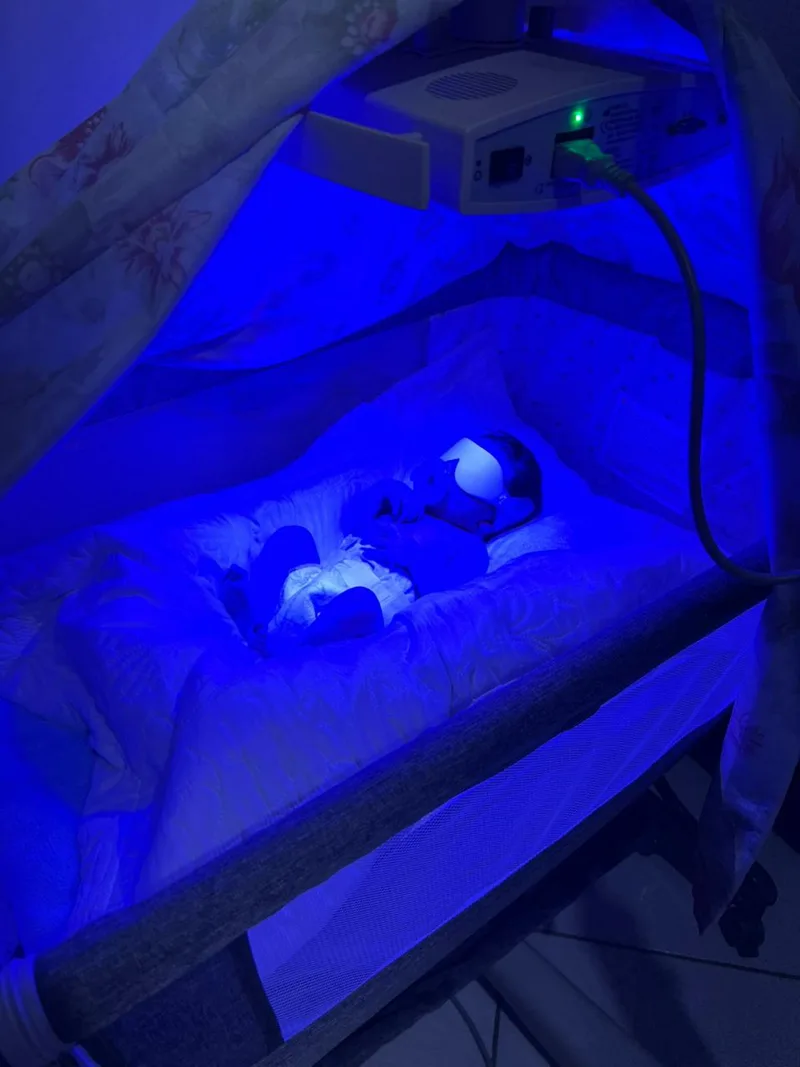 Bebê recém-nascido recebendo fototerapia em casa