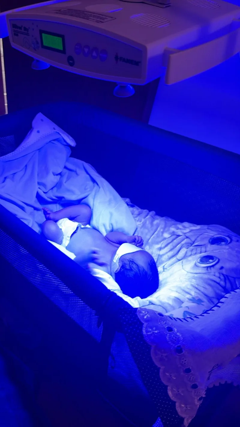 Bebê com fototerapia domiciliar