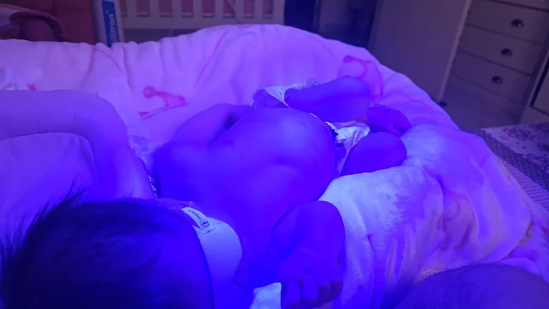 Família após tratamento de fototerapia em casa