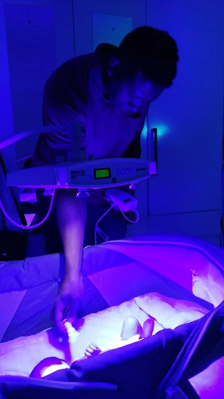 Bebê saudável após banho de luz domiciliar